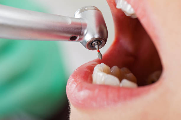Best Dentist for Tooth Abscess  in Wills Point, TX
